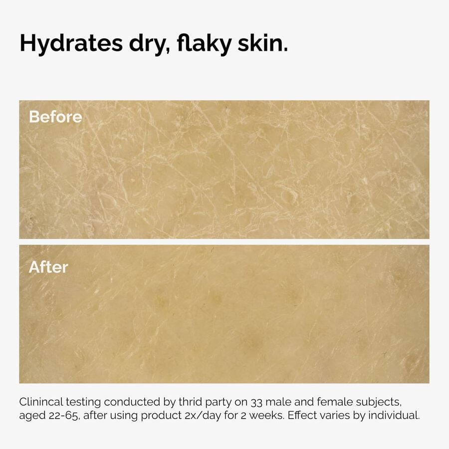 the-body-care-collection-s2 ord-natural-moisturizing-factors-inulin-body-before-after-graphic-02.jpg