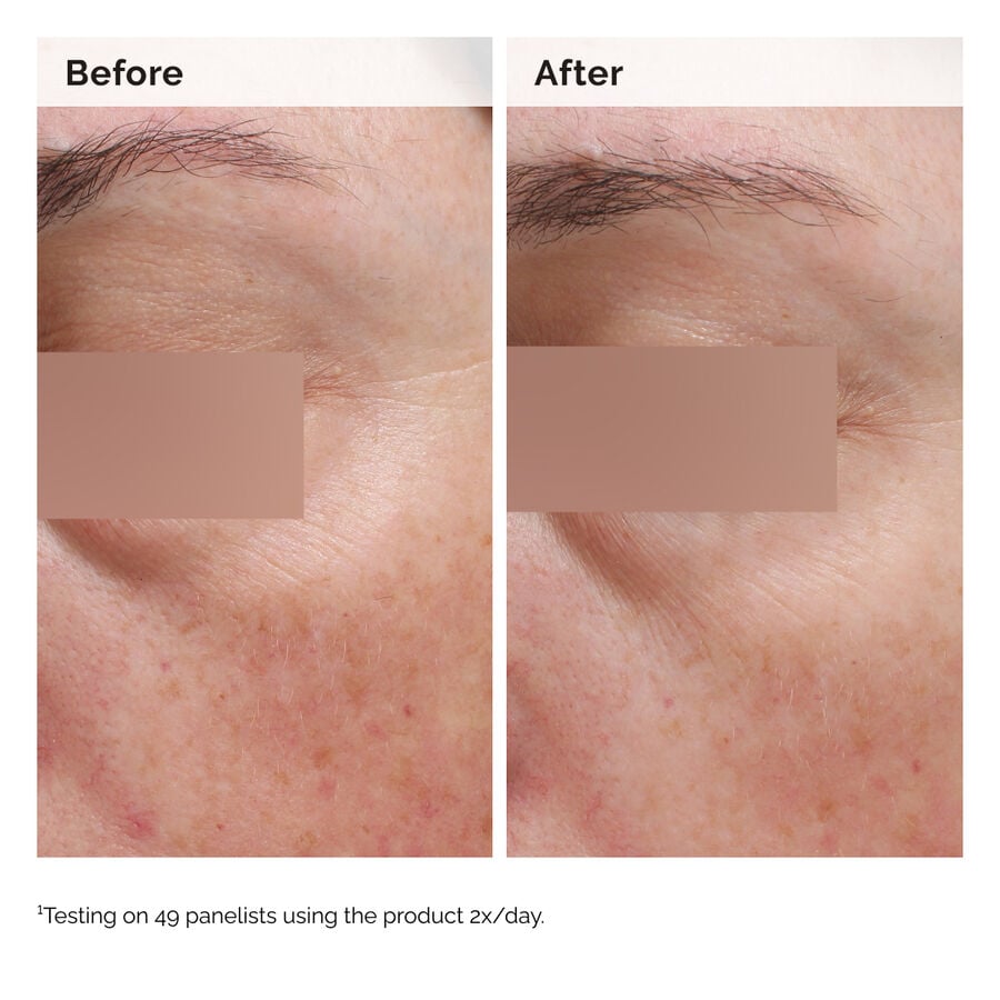 niacinamide-5-face-and-body-emulsion-g2 2024-08-23-ORD-Nia-5pct-Face-Body-B-A-Elasticity-Global-02-1x1.jpg