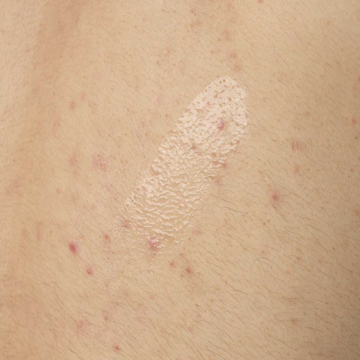salicylic-acid-0-5-body-serum-n5 ORD-salicylic-acid-05-body-240ml-application.jpg