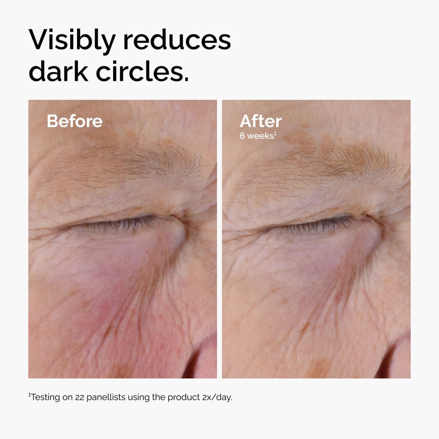caffeine-solution-5-egcg-eye-serum-f8 ord-caffeine-solution-egcg-dark-circles-before-after.jpg