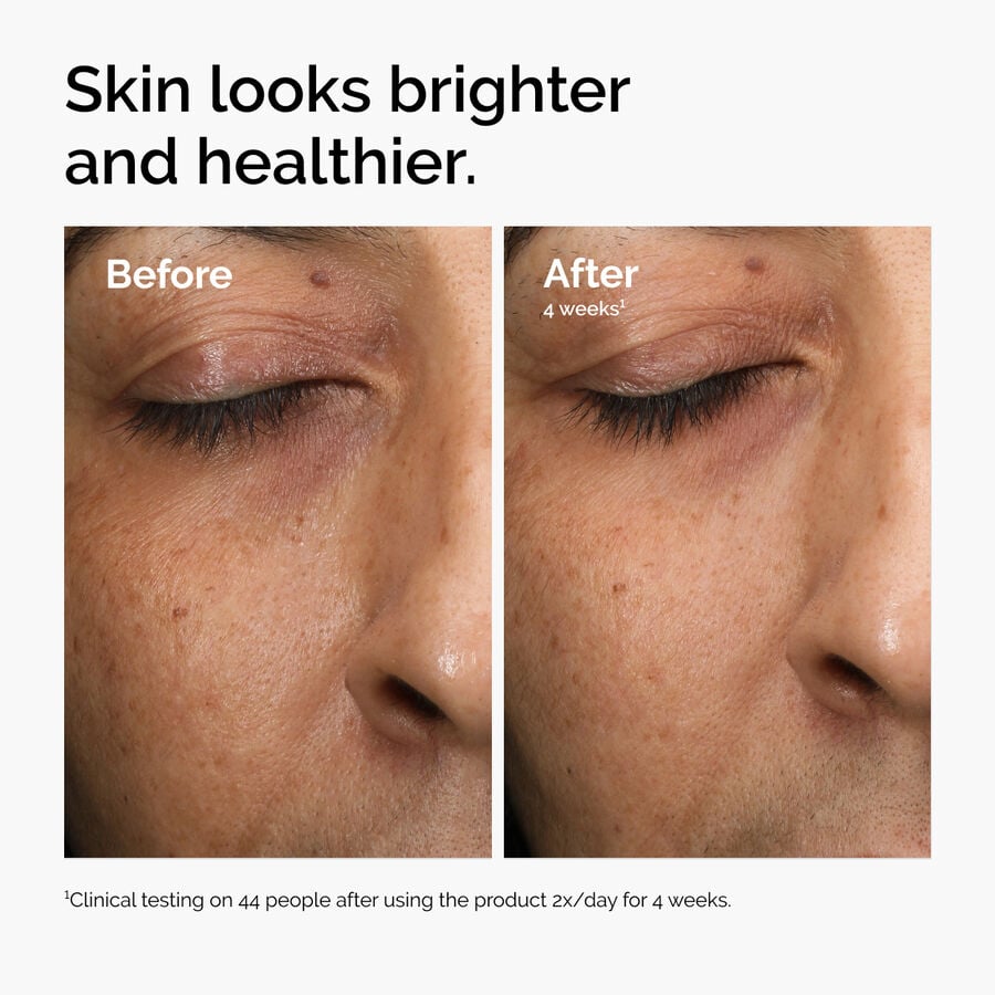 multi-antioxidant-radiance-serum-g7 ord-mars-before-after-healthy.jpg