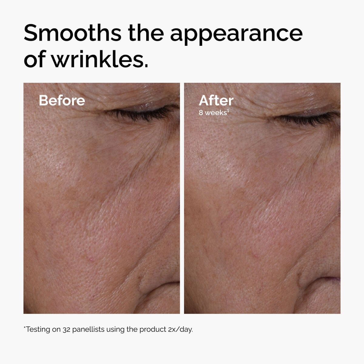 multi-peptide-ha-serum-s7 ord-multi-peptide-ha-serum-wrinkles-before-after.jpg
