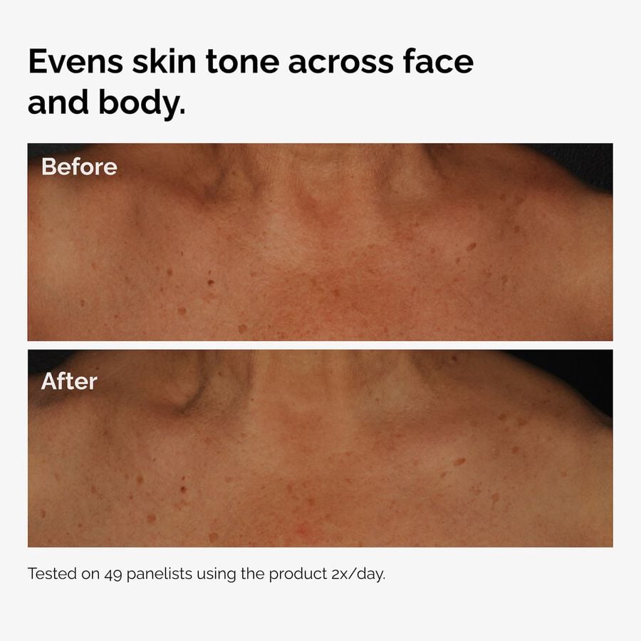 the-body-care-collection-s2 ord-niacinamide-face-body-serum-before-after-even-tone-graphic.jpg